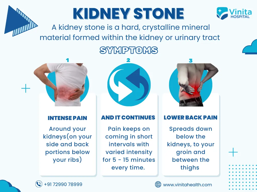 Best Kidney Stone Hospital in Chennai