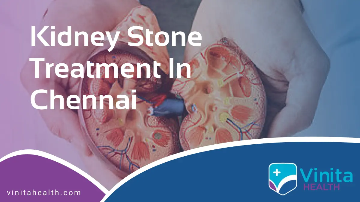 Kidney Stone Treatment in Chennai