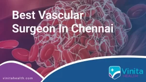 Best Vascular Surgeon in Chennai