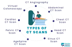 CT Scan in Chennai