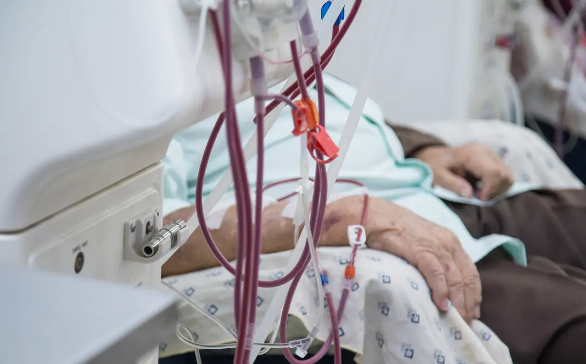 Hemodialysis and Peritoneal dialysis