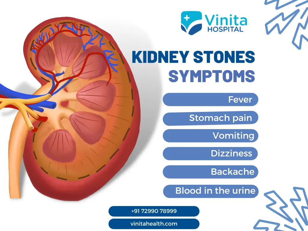 Kidney Stone Early Symptoms