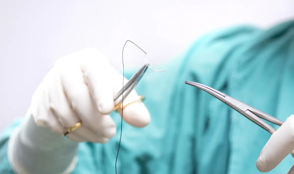 Suture removal
