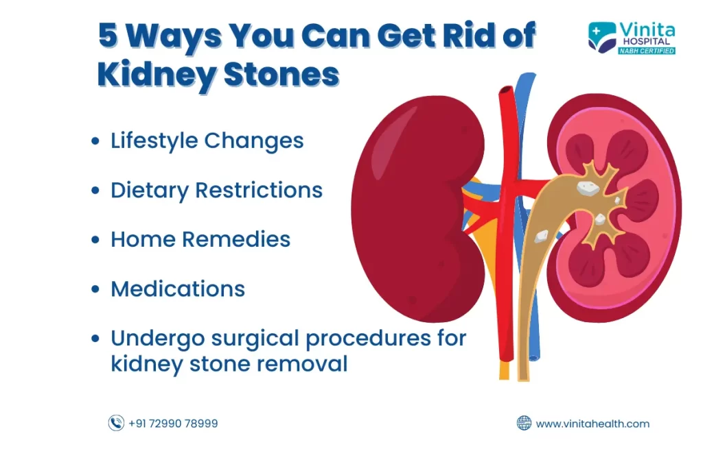 How to Remove Kidney Stones | Vinita Health