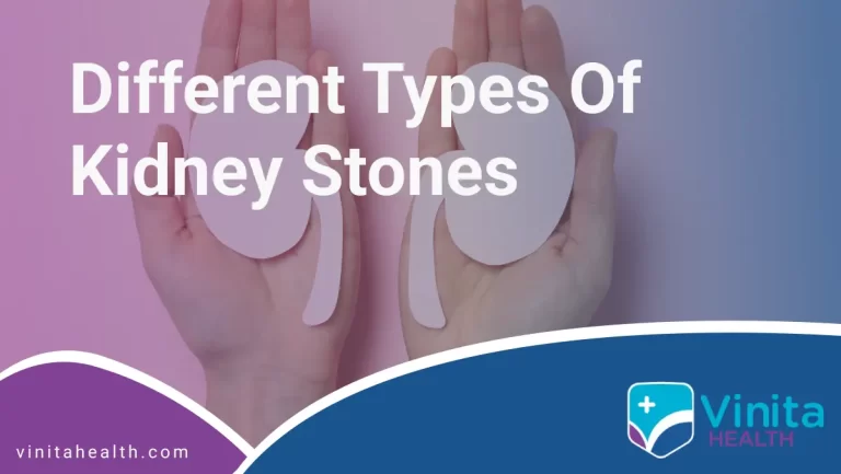 Different Types of Kidney Stones