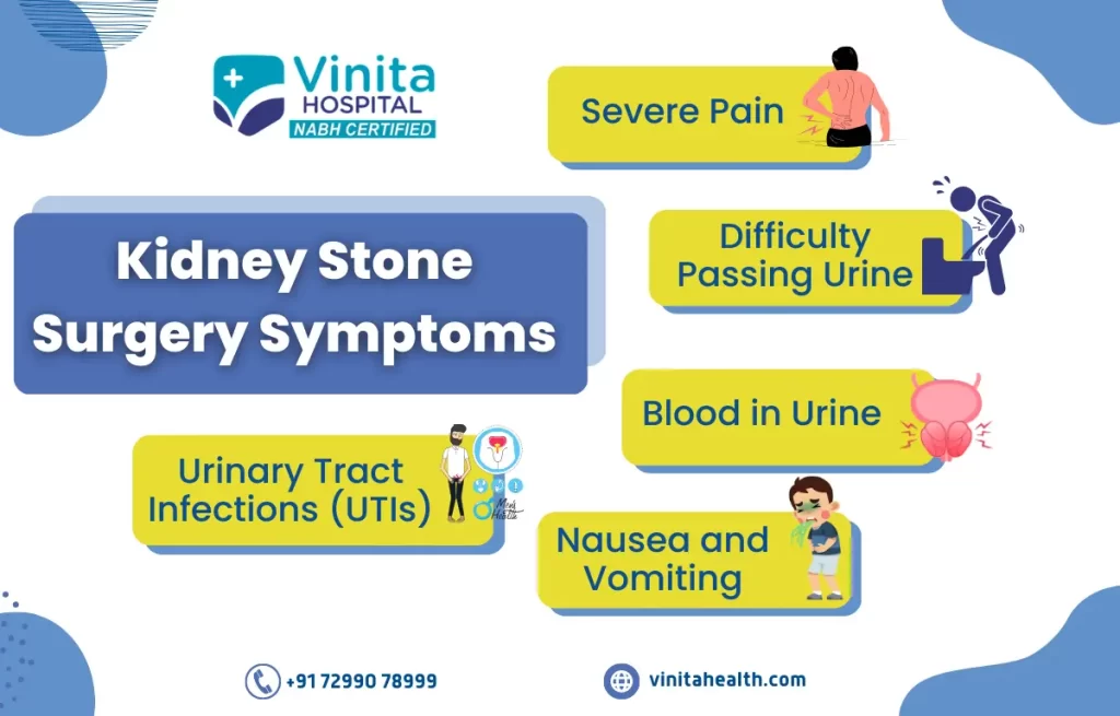 Kidney Stone Surgery in Chennai