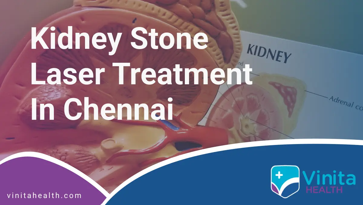 Kidney Stone Laser Treatment in Chennai