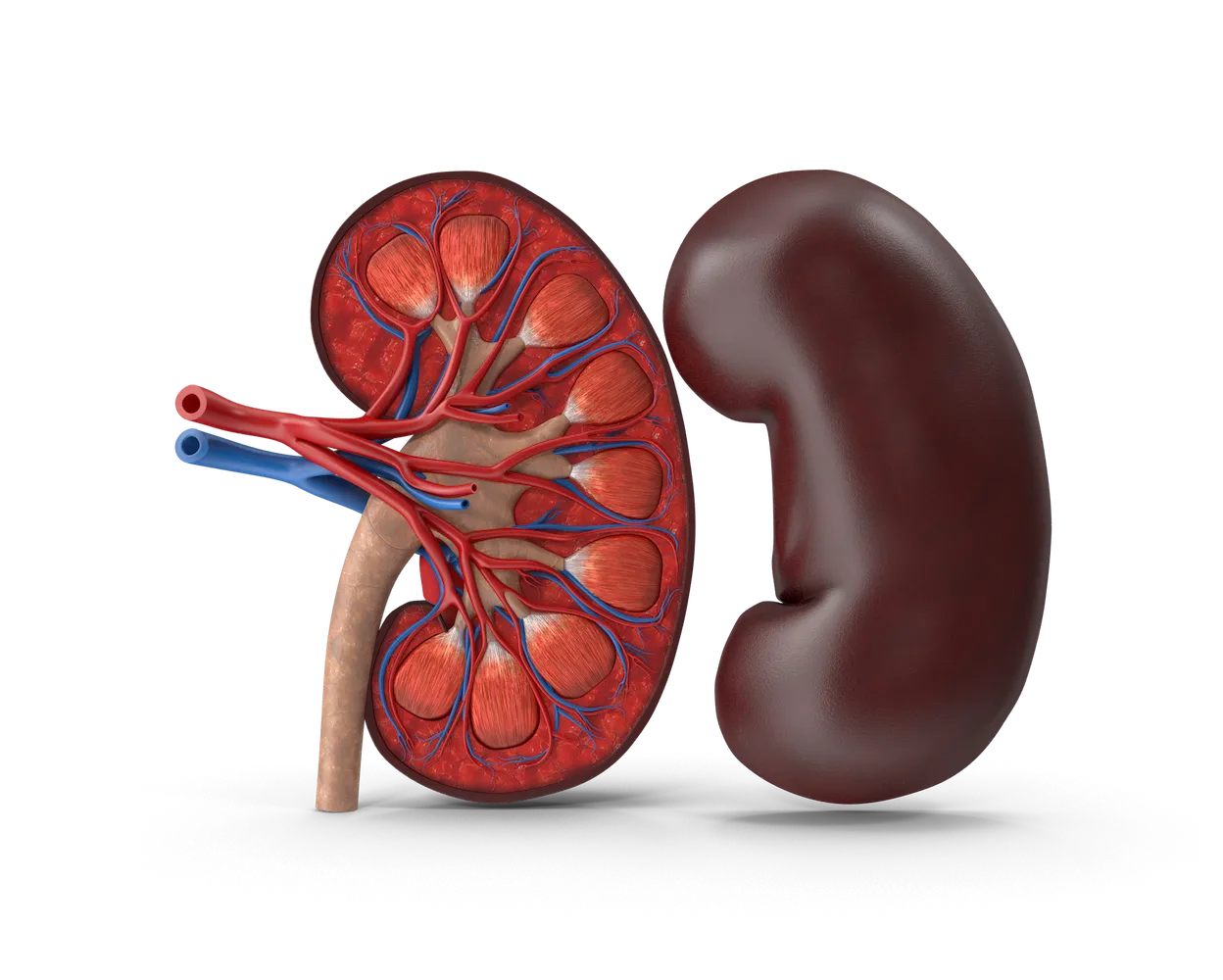 What is Kidney Transplant