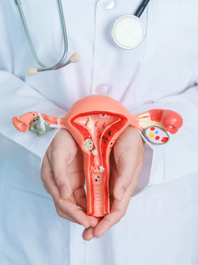 doctor-holding-uterus-ovaries-model-ovarian-cervical-cancer-cervix-disorder-endometriosis-hysterectomy-uterine-fibroids-reproductive-system-pregnancy-concept